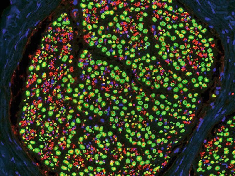 Querschnitt durch einen peripheren Nerv der Maus. Einzelne Axone wurden in rot markiert. Schwann Zellen, die die Axone mit einer fettreichen Isolationsschicht ringförmig ummanteln, sind in grün dargestellt. Die Zellkerne aller Zellen im Nerv sind blau markiert.