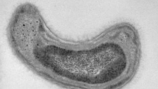 Das Bakterium Methylosinus trichosporium hat durch seinen speziellen Stoffwechsel einen hohen Bedarf an Kupfer. (Jeremy Semrau, University of Michigan)