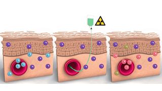 Residente T-Zellen (lila) überleben bei manchen Patienten Bestrahlung und Chemotherapie. Spenderzellen (pink und grün) sind dann hauptsächlich im Blut zu finden. (Bild: Daniela Leitner/Science Immunology)
