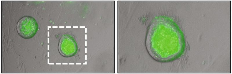 Humane Organoide gezüchtet aus Dünndarmgewebe (Zwölffingerdarm, Duodenum). Organoide bestehen aus einer Schicht Epithelzellen, die das innere Lumen umschließen. Kleinere Transportsubstrate (Zucker, Proteine, Medikamente) können in das Lumen der Organoide diffundieren, hier mit einem Fluoreszenz-Farbstoff gezeigt (grün, 4kDa FITC). Das Innere der Organoide entspricht dem Darminneren, in dem Transporter für verschiedene Substanzen lokalisiert sind. (Bild: E. Rath / TUM)