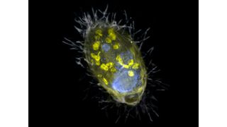 Darstellung des Endosymbionten „Candidatus Azoamicus ciliaticola“ und seines Wirtes, eines Wimpertierchens. Zu sehen sind der Endosymbiont (gelb) und die bakterielle Beute in Nahrungsvakuolen sowie der große Zellkern (blau). Die äußere Struktur des schwach fluoreszierenden Ciliaten sowie die Wimpern sind ebenfalls sichtbar (Bild: S. Ahmerkamp/Max-Planck-Institut für Marine Mikrobiologie)