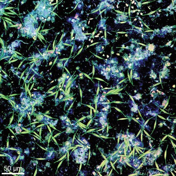 Von Bakterien und Mikroalgen auf einer Plastikoberfläche in Wasser aus der Kieler Förde gebildeter Biofilm. Die Aufnahme wurde mit Konfokaler Laserrastermikroskopie angefertigt. (Jan Michels/Future Ocean)