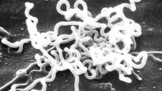 Elektronenmikroskopische Aufnahme von Treponema pallidum (Bild: CDC/Dr. David Cox)