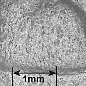 1   Mikrobild einer typischen lasttragenden Lageroberfläche mit extrem langer Einkerbung. 