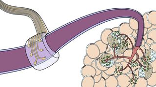 Flexible Elektrode in Verbindung mit einem Nervenstrang (TU München/ Philipp Rinklin)