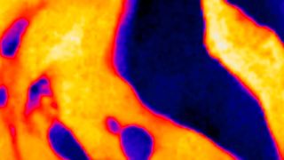 Spezielle Röntgenaufnahme eines Knochens: Die Farben geben Auskunft über die Verteilung verschiedener chemischer Elemente.  (TU Wien)