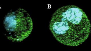Abb. 1: Segregation des Numb Proteins während der Zellteilung in Brust-Stammzellen – normale Brust- (A) und Krebs-Stammzellen (B).  (Bild: IFOM-IEO)