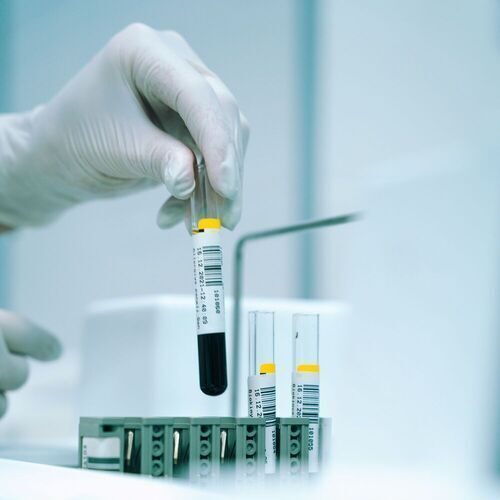 The new method, Bayescna, can extract information that was previously hidden in low-quality samples and provide more detail about the tumor’s composition. (Source:  Unsplash)