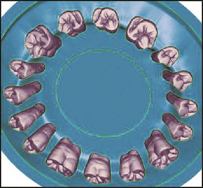 Für Zahnimplantate, Titan Grad 4, erreicht der Dixi 1730 1500 bearbeitete Gewinde. (Bild: Dixi)