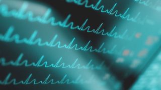 Für mehr Sicherheit im Netzwerk müssen die verschiedenen Geräte ihren Status kommunizieren, Sophos spricht auch von synchronisierter Sicherheit und dem Security Heartbeat. (sudok1 - Fotolia.com)