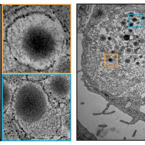 (Bilder: aus Saxena et al., Nature Comm., 2016)