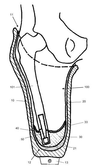 Ein Prothesenschaftsystem sowie Prothesenschaft und Prothesenliner.(Bild:  DPMA)