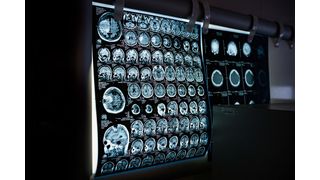 A group of tests that would have otherwise taken two to three hours to complete can now be reliably done in under 30 minutes. (Source: Pixabay)