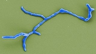 Elekronenmikroskopische Aufnahme des myzelbildenden Bodenbakteriums Ktedonobacter racemifer.  (Bild: Manfred Rohde, Helmholtz-Zentrum für Infektionsforschung)