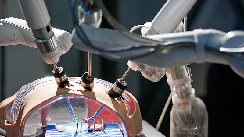 Sanft und feinfühlig: Das Chirurgie-Robotersystem MiroSurge des DLR. Die minimal-invasive, sogenannte 