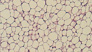 Das Enzym NNMT reguliert den Energieverbrauch im Fettgewebe. Das Bild zeigt einen mikroskopischen Schnitt durch das Fettgewebe einer Maus, die durch gezielte Unterdrückung des Enzyms schlank wurde. (Bild: Daniel Kraus / Uniklinikum Würzburg)