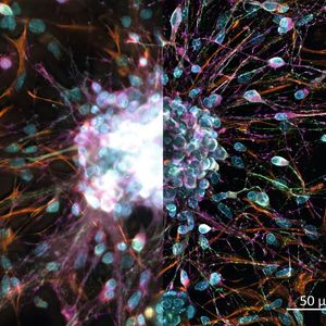 (Mit freundlicher Genehmigung von H. Braun, LSM Bioanalytik GmbH, Magdeburg)