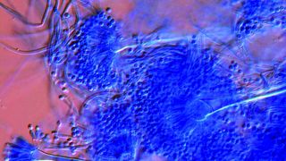 Abb. 1: Einige Arten der Schimmelpilzgattung Aspergillus bilden als Stoffwechselprodukte hochtoxische Mykotoxine der Gruppe Aflatoxine.  (Bild: www.enius.de)