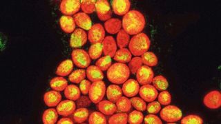 Mikroskopische Abbildung von Hydra-Epithelzellen (Zellkerne in grün), die jeweils etwa 20-30 symbiotische Chlorella-Algen enthalten (in orange). (Jay Bathia)