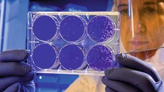 Elektrochemische Methoden unter Verwendung von SPEs können eine praktikable alternative Lösung für schnelle und unkomplizierte Tests auf Viren am Point of Care sein. (Metrohm)