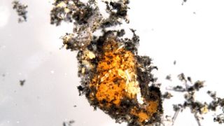 Die Konsortien aus Archaeen und bakteriellen Partnern unter dem Mikroskop. Die schwarzen Stellen sind zum Teil durch elementaren Kohlenstoff so gefärbt. (Gunter Wegener/ Benedikt Geier, MPI Bremen)