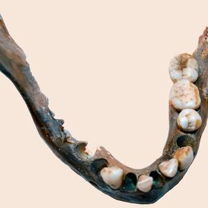 Mandible of a hunter-gatherer woman who lived 7900 years ago at Matjes River Rockshelter in the Western Cape, South Africa,  for whom a genome was reconstructed.(Source:  Helena Malmström)