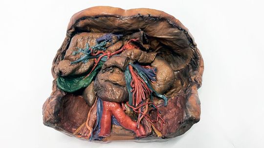 Fotorealistisch: Dieses medizinische Modell von Erler Zimmer wurde mit dem Mimaki 3DUJ-553 gedruckt. (Bild:  Mimaki)