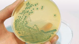 Abb.1: Listerien sind eine der zahlreichen potenziellen Gefahrenquellen, auf die Proben am LALLF untersucht werden. (LALLF M-V)