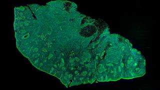 Falschfarben-RGB-Bild einer cm-großen Gewebeprobe, gemessen mit der Zwei-Photonen-Bildgebung. Grün ist eine fluoreszierende Proteinfärbung, rot ist eine DNA-Färbung und blau ist SHG in geordnetem Kollagengewebe. Dieses Bild wurde aus Hunderten von Bildern mit subzellulärer Auflösung zusammengesetzt, die in insgesamt weniger als einer Minute aufgenommen wurden. (Bild: Prof. Michael Giacomelli/Universität von Rochester)