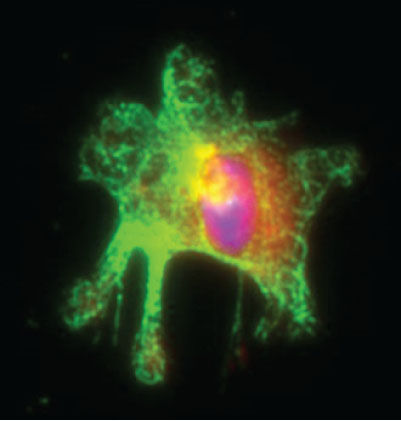 Activated macrophage isolated from mouse intestine. Macrophage marker is shown in green, inflammation marker (iNOS) in red, and nucleus in blue.  (Catrin Youssif, IRB Barcelona)