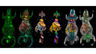 Whole-body 3D reconstruction
 (Source: Ali Ertürk Lab/ Helmholtz Munich)