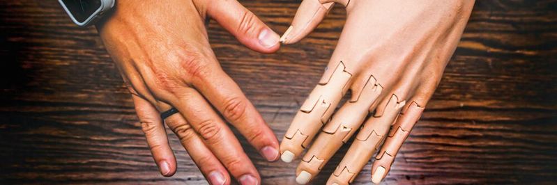 Unlimited Tomorrow setzt den digitalen Zwilling ein, um hochwertige, leichte und kostengünstige Armprothesen für Kinder und Erwachsene herzustellen.(Bild:  Siemens Digital Industries Software)