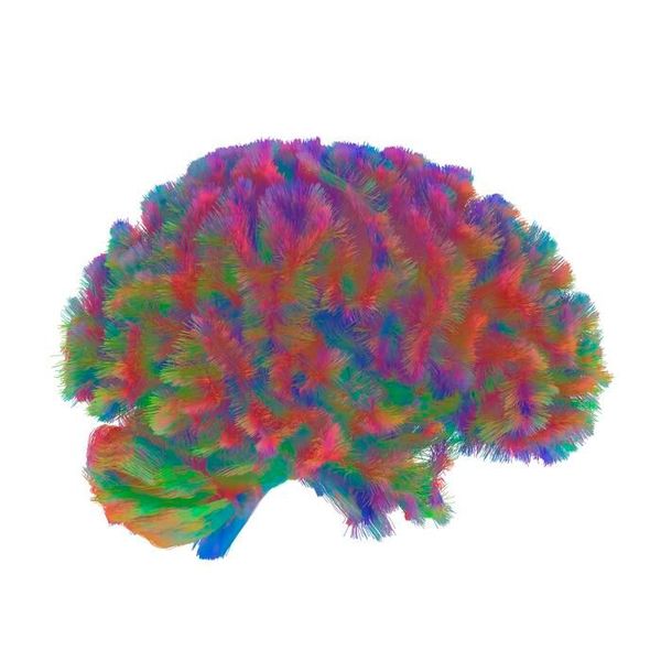 A representative MRI tractography image of the fifth era of the human brain. This image is representative of the general pattern seen across the brains in the study during the fifth era of neural wiring, the the “late aging” phase.  (Source: Dr Alexa Mousley/ University of Cambridge)