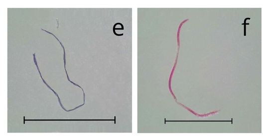 Abbidlung 2: Plastikfasern als häufigster Plastiktyp in den Seen (Balken: 1mm).(Bild:  IGB Berlin)