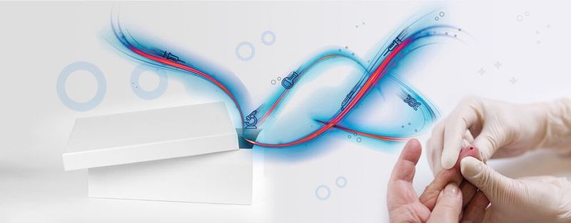 Abb. 1: Die präzise Analyse von sehr kleinen Blutvolumina ist Ziel eines neues Verbundprojektes. Abb. 1: Die präzise Analyse von sehr kleinen Blutvolumina ist Ziel eines neues Verbundprojektes.