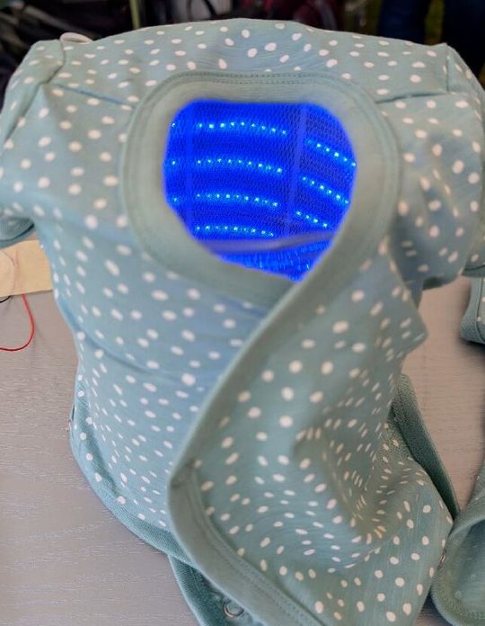 Sensorgesteuerter Neugeborenen-Gelbsucht-Body für Phototherapie (Bild:  Filk Freiberg Institute)