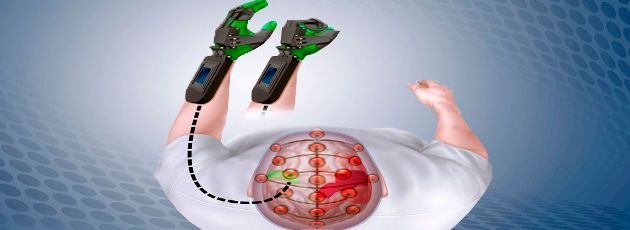 Diagramm der so genannten „Ipsihand“ im Einsatz: Das Gerät spürt Impulse im unbeschädigten Bereich des Schlaganfallpatienten (grün dargestellt), was dazu führt, dass sich die Plastikschiene an der Hand entsprechend öffnet und schließt. Durch stetige Wiederholung hilft die Ipsihand die heilen Gehirnbereiche zu trainieren und nach und nach Funktionen zu übernehmen, die zuvor von den durch den Schlaganfall beschädigten Hirnzellen durchgeführt wurden. Diagramm der so genannten „Ipsihand“ im Einsatz: Das Gerät spürt Impulse im unbeschädigten Bereich des Schlaganfallpatienten (grün dargestellt), was dazu führt, dass sich die Plastikschiene an der Hand entsprechend öffnet und schließt. Durch stetige Wiederholung hilft die Ipsihand die heilen Gehirnbereiche zu trainieren und nach und nach Funktionen zu übernehmen, die zuvor von den durch den Schlaganfall beschädigten Hirnzellen durchgeführt wurden.