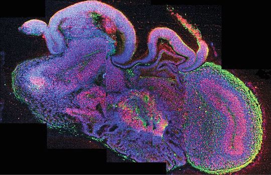 Querschnitt eines vollständigen cerebralen Organoids mit verschiedenen Gehirnregionen. Zellen sind in blau, neuronale Stammzellen in rot und Neuronen in grün dargestellt. Querschnitt eines vollständigen cerebralen Organoids mit verschiedenen Gehirnregionen. Zellen sind in blau, neuronale Stammzellen in rot und Neuronen in grün dargestellt.