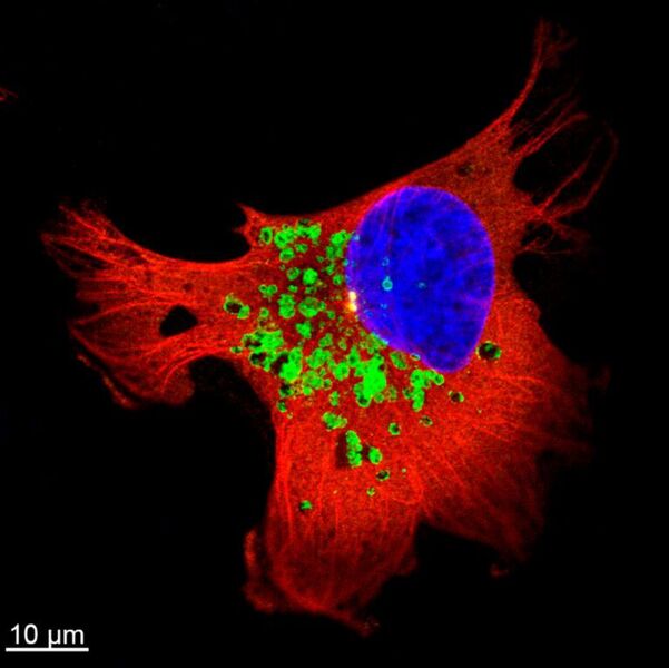 Fluorescence micrograph of breast cancer cell line showing the lysosome (green), DNA (blue), and cell skeleton (red).  (Ping-Hsiu Wu)