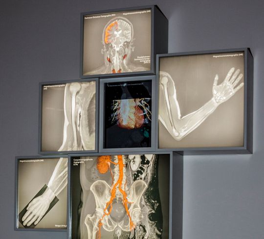 Viele Bildgebungsverfahren, um in das Innere des Menschen zu schauen. Der sogenannte Image Man zeigt sein Geheimnis. Viele Bildgebungsverfahren, um in das Innere des Menschen zu schauen. Der sogenannte Image Man zeigt sein Geheimnis.