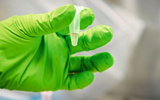 Abwasserprobe vor der Sequenzierung Abwasserprobe vor der Sequenzierung