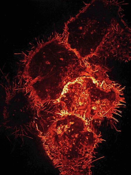 Mikroskopieaufnahme von menschlichen Zellen, die Virosomen produzieren. Für das Bild wurden die Zellen so verändert, dass sie fluoreszierendes Ebola Hüllprotein produzieren. Dieses wird in die Zellmembranen eingebaut und schnürt sich in Form von Virosomen ab. (Universitätsklinikum Tübingen)