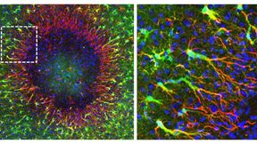 Die Abbildung links zeigt eine Hirnverletzung (Durchmesser: knapp 0,5 Millimeter). Am Rand der Läsion beginnen die neu entdeckten «regenerativen» Astrozyten, das defekte Gewebe zu reparieren. Sie bilden lange Zellfortsätze (rot) aus, entlang derer die neu gebildeten Zellkerne (blau) in Richtung der geschädigten Region wandern. Darum herum befinden sich unveränderte Astrozyten (grün). Die Abbildung rechts zeigt eine Vergrößerung des markierten Bereichs links.  (Bild: Institut für Pharmakologie und Toxikologie, UZH)