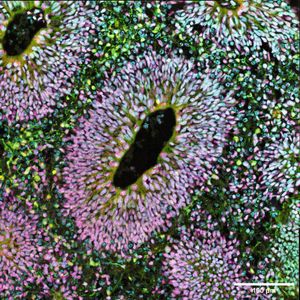 Ventrikel eines menschlichen Hirnorganoids(Bild:  Indra Niehaus, Medizinische Hochschule Hannover)