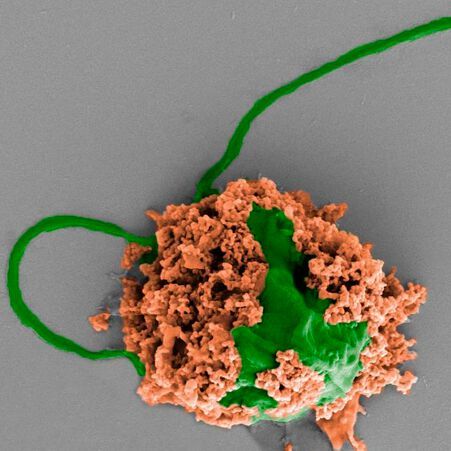 Colored SEM image of a pneumonia-fighting microrobot made of an algae cell (green) covered with biodegradable polymer nanoparticles (brown). The nanoparticles contain antibiotics and are coated with neutrophil cell membranes. Colored SEM image of a pneumonia-fighting microrobot made of an algae cell (green) covered with biodegradable polymer nanoparticles (brown). The nanoparticles contain antibiotics and are coated with neutrophil cell membranes.