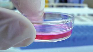 Abb. 1: Die exakte Bestimmung der Zellzahl ist erforderlich, um beispielweise die Qualität einer Zellkultur zu überprüfen. (Quelle: www.free-photos.biz) (Archiv: Vogel Business Media)