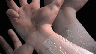 Eine Unterarmmanschette mit 64 Elektroden und KI-Chip erkennt die beabsichtigten Handzeichen des Trägers. (Rabaey Lab)