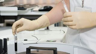 Das klassische Nachweisverfahren sepsiserregender Pilze dauert zum Teil mehrere Tage, da der Pilz aus Körpergewebe oder Blut extrahiert und in einer Nährkultur vermehrt werden muss. (gemeinfrei)