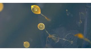 Die einzellige Amöbe Dictyostelium discoideum kann sich zu einem vielzelligen Verband zusammenschließen und Fruchtkörper ausbilden, die Sporen produzieren. (Bild: Falk Hillmann/Leibniz-HKI)