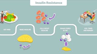 Bei zu viel Zuckerkonsum kann sich eine Insulin-Resistenz etwickeln. Dann hören die Zellen schlechter auf die körpereigenen Botenstoffe (hier: Insulin) – und Zucker wird verstärkt in Fettzellen eingelagert. (Bild: TarikVision - stock.adobe.com)